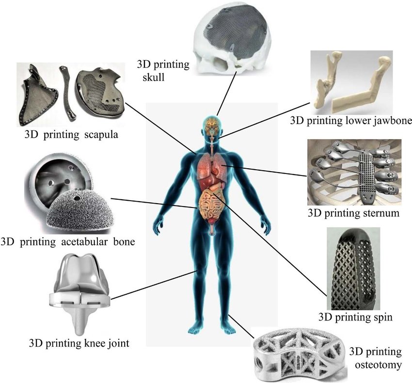 application and Development of 3D Printing in the Medical Field
